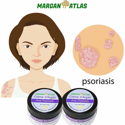 Psoriasis cream - Anti-psoriasis argan cream